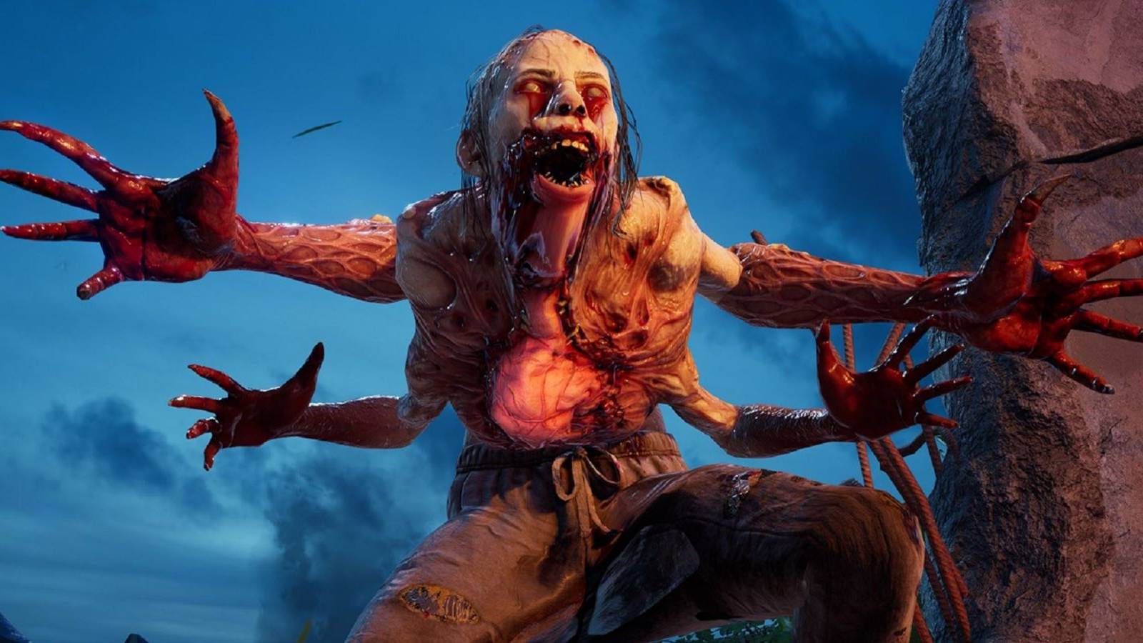 back-4-blood-ultimate-vs-deluxe-editions