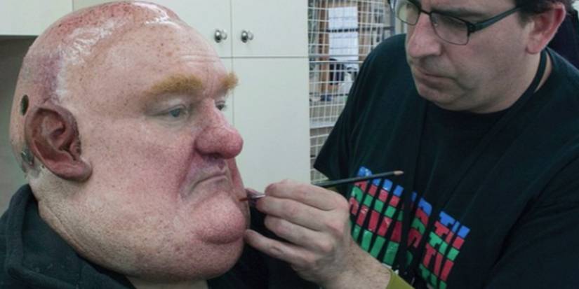 Bombur Prosthetics