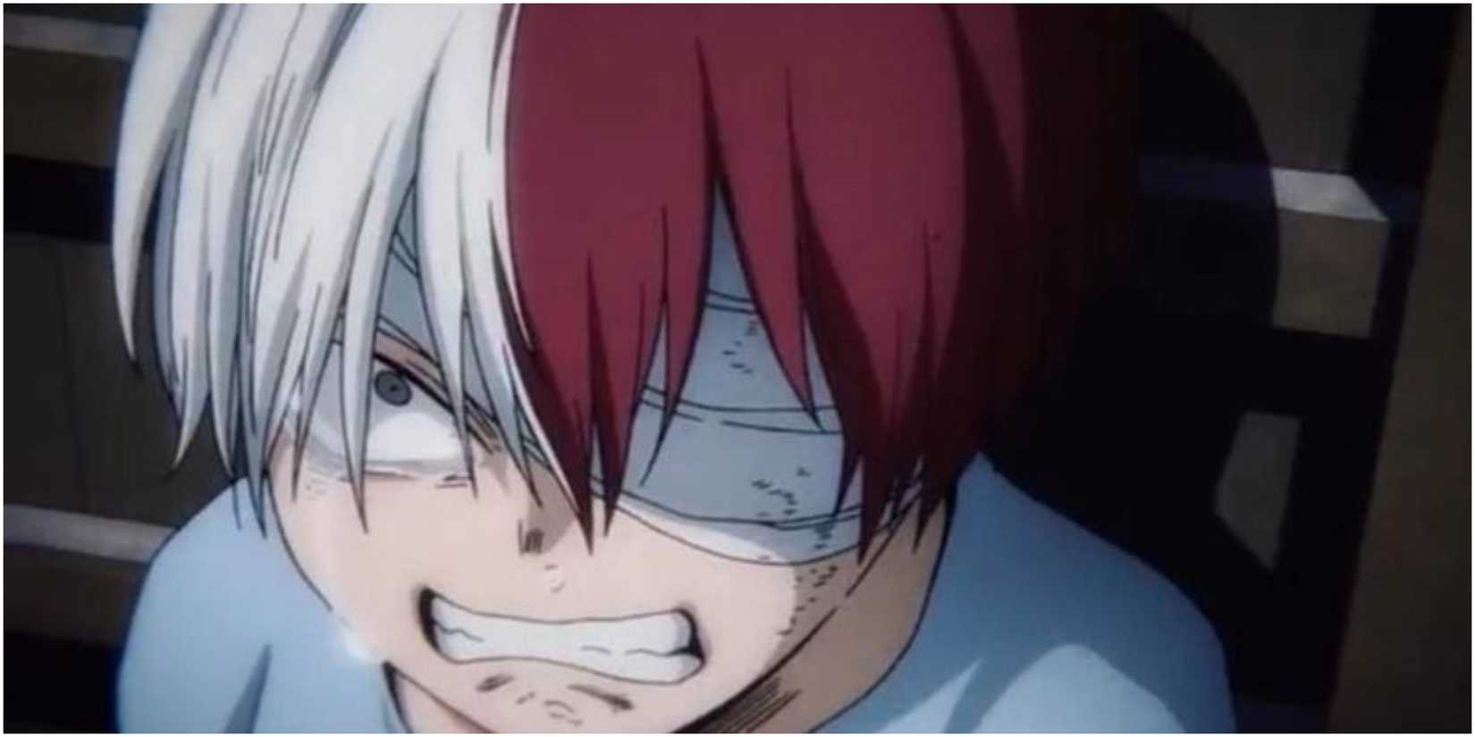 My Hero Academia Shoto After Being Burned