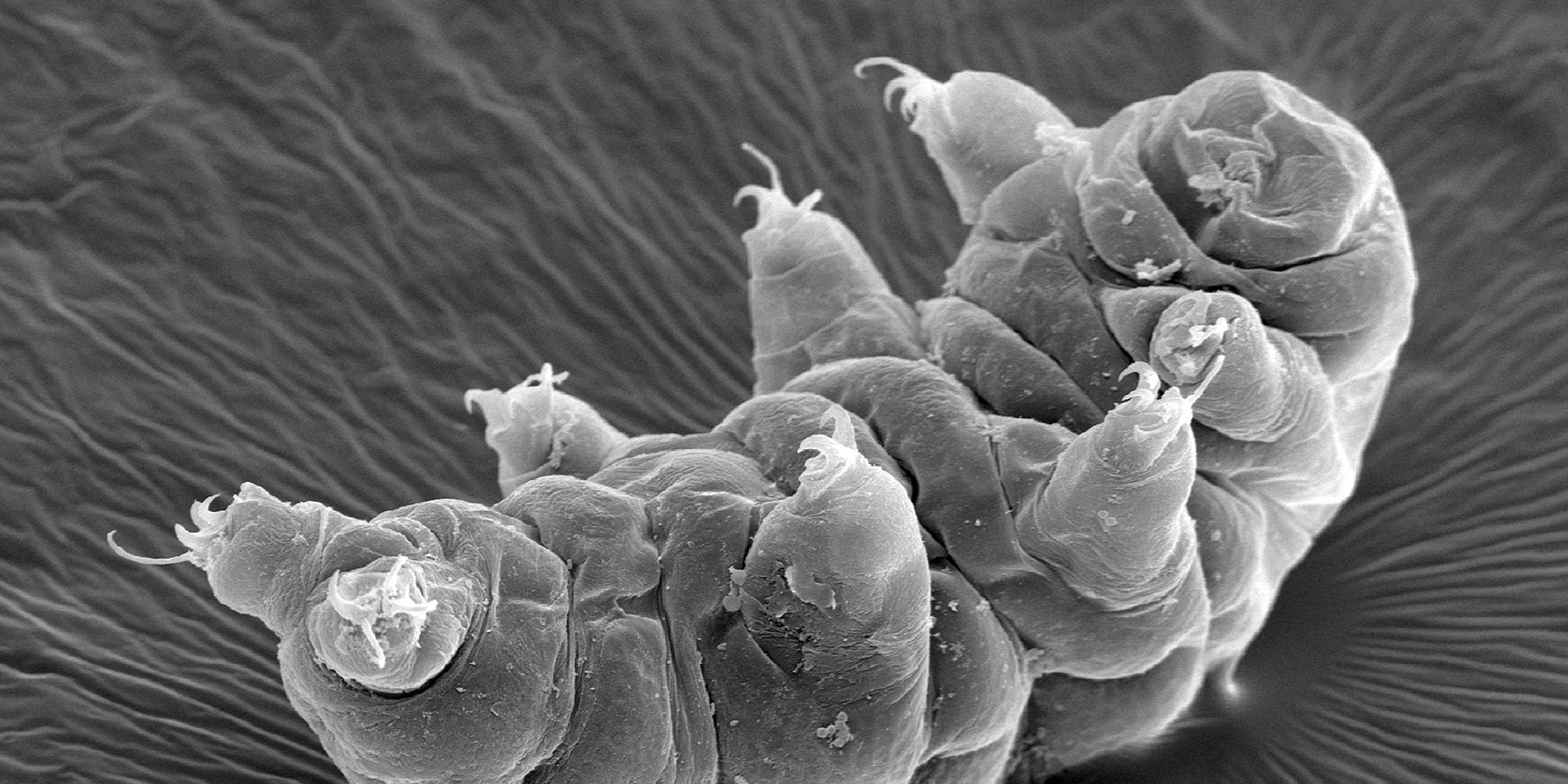 A black and white microscopic image of a tardigrade