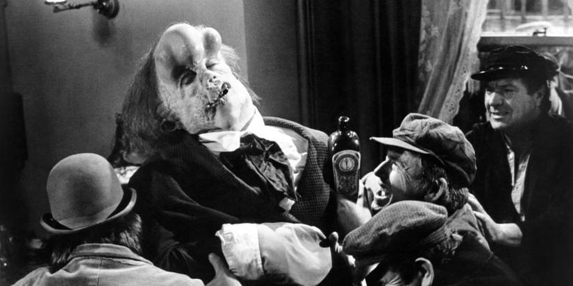The Elephant Man 1980