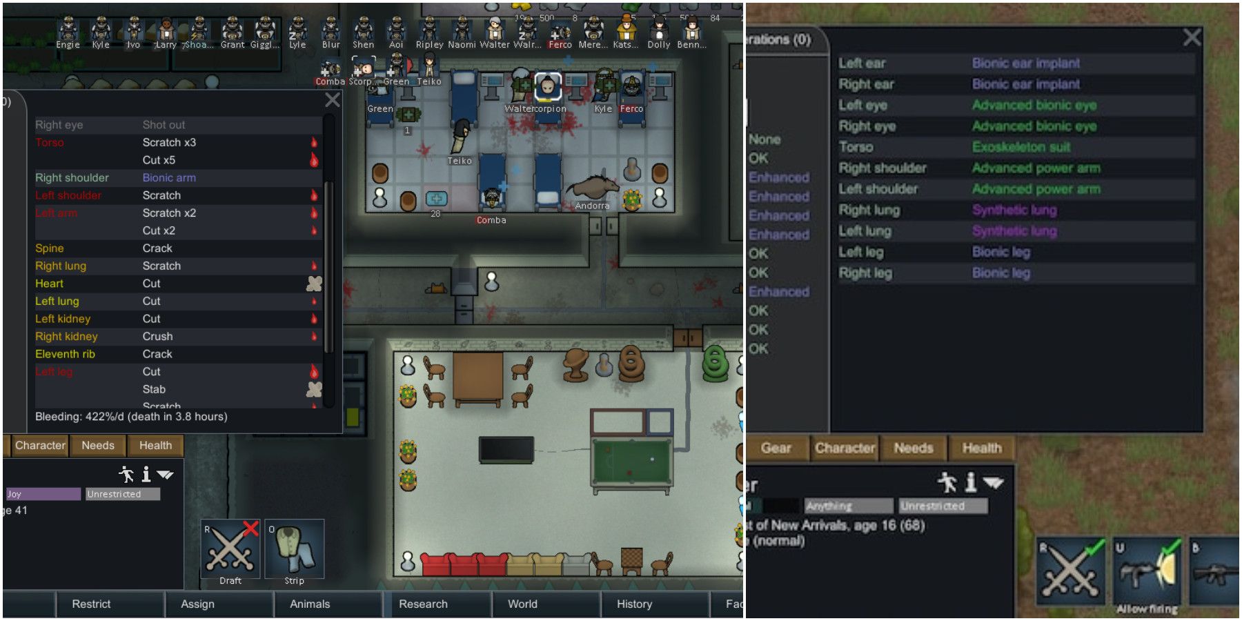 Player installing a Bionic Arm on a colonist in Rim World.