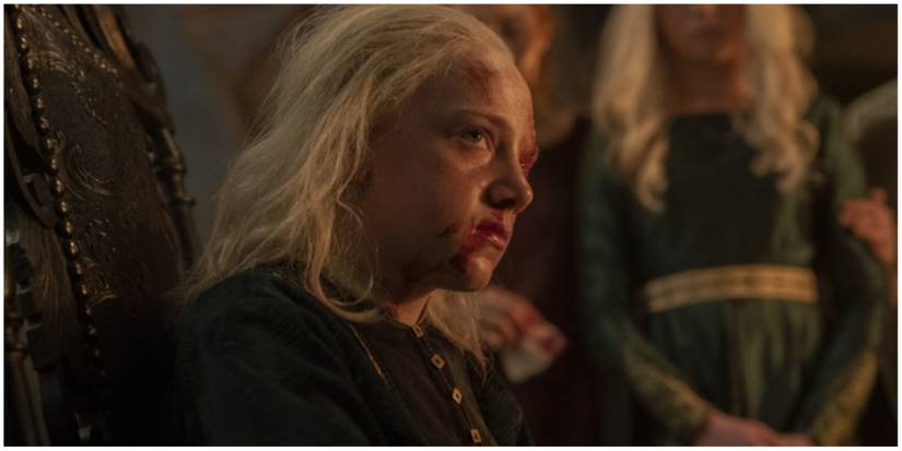 Young Aemond After Losing His Eye To Lucerys