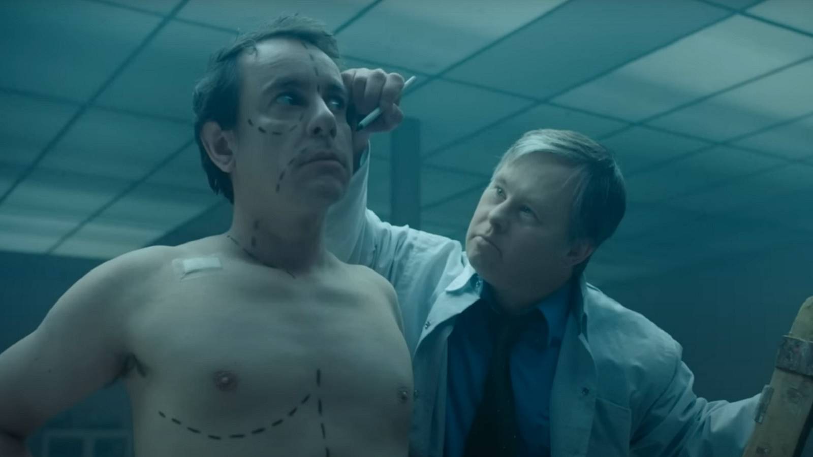 downside up surgery prep