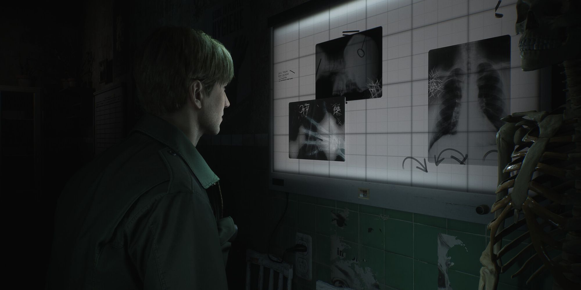 James looking at X-rays in Silent Hill 2