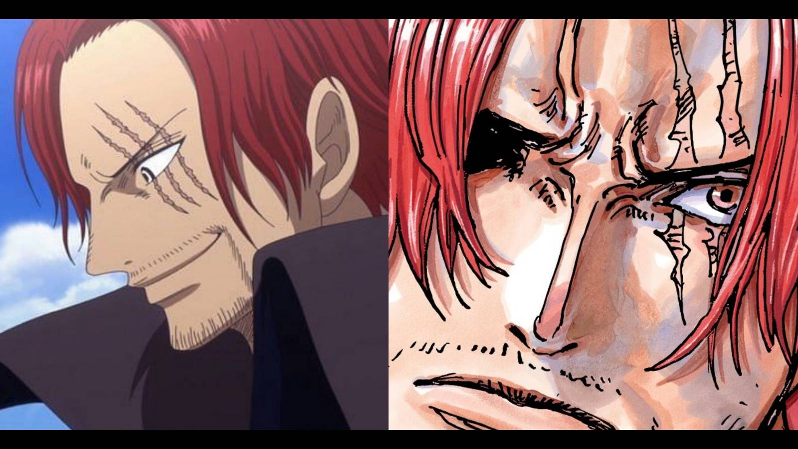 Shanks