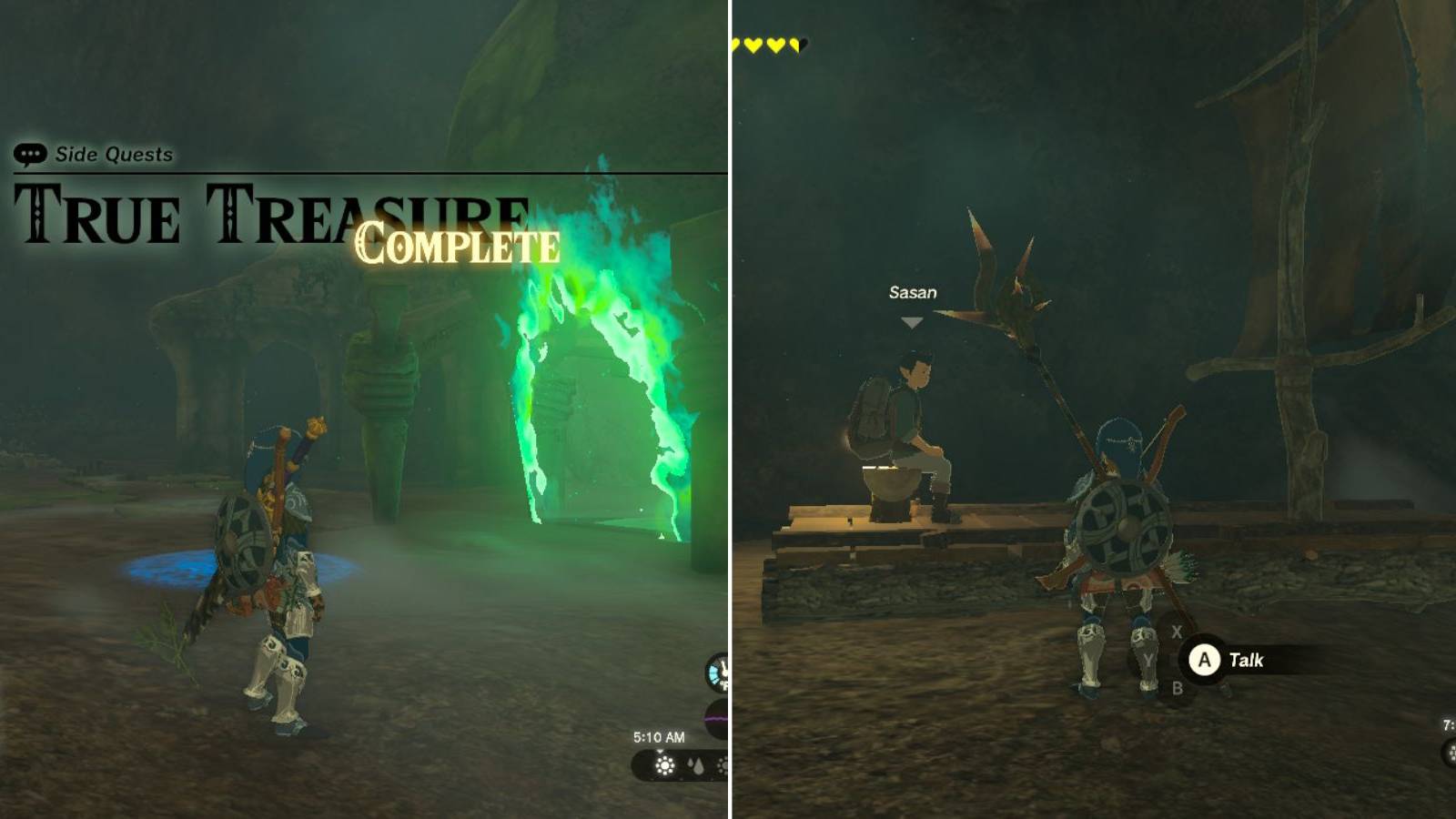 Zelda Tears of the Kingdom True Treasure