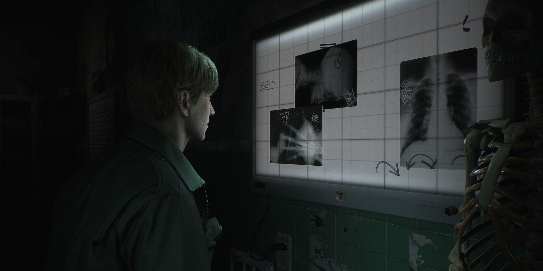 James Sunderland examining some x-ray images