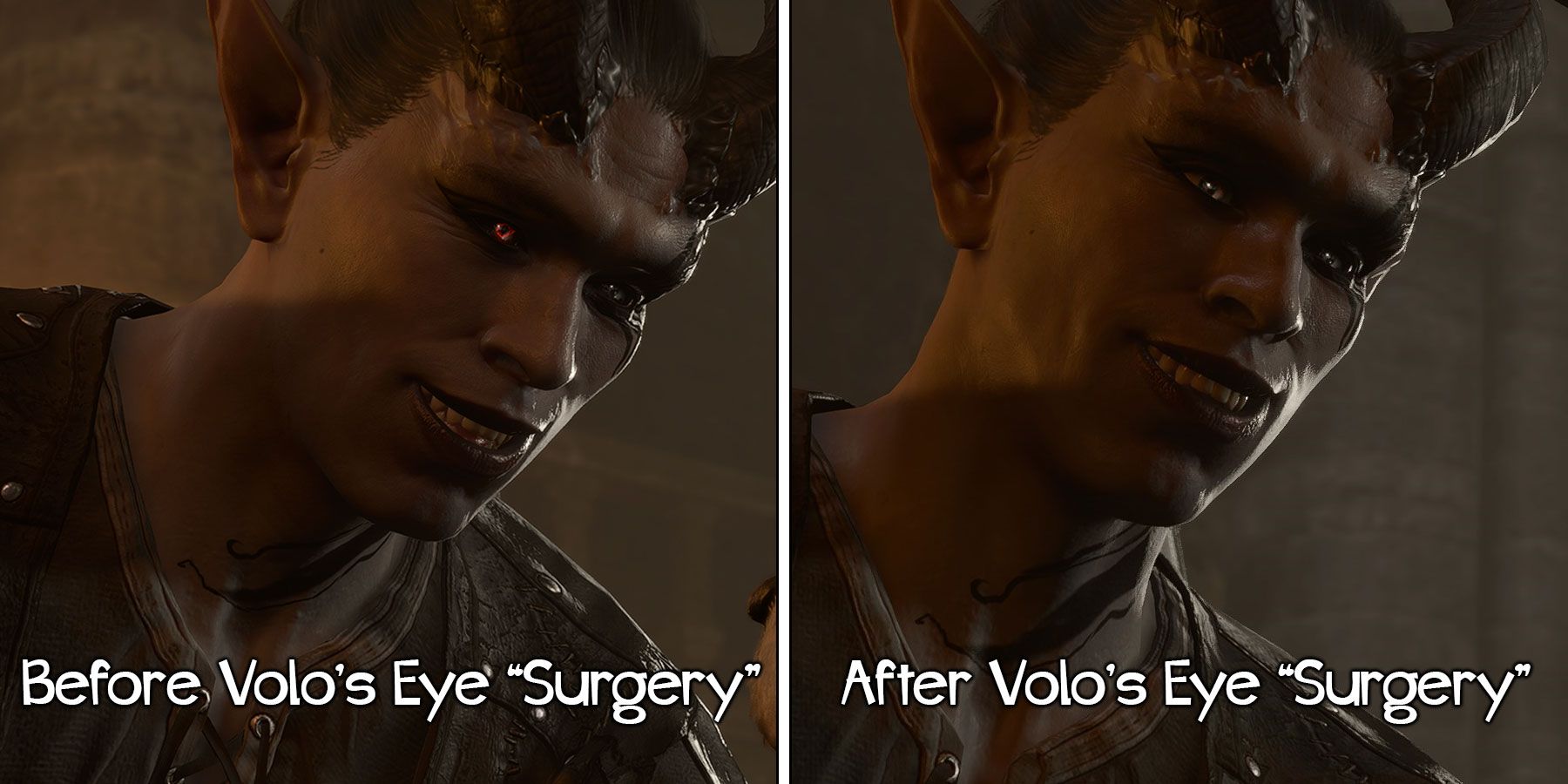 Volo's eye surgery before and after in Baldur's Gate 3.