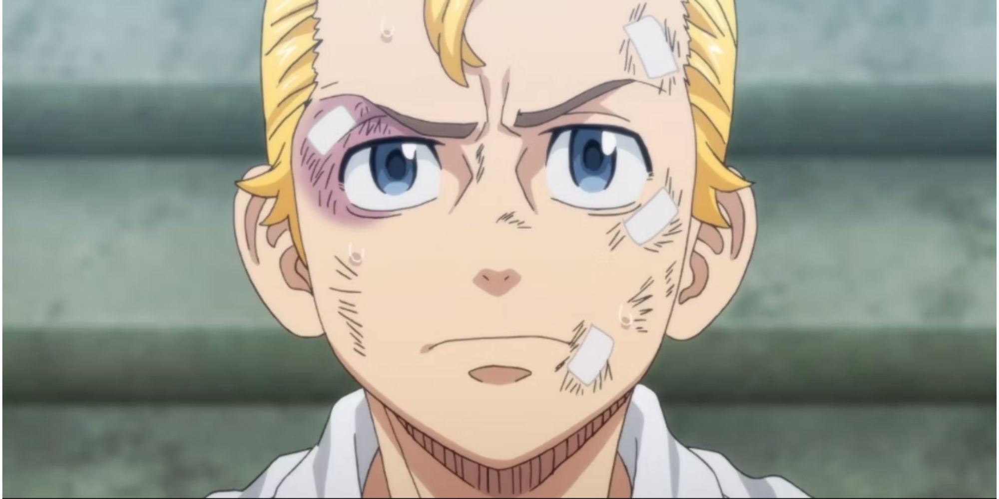 a blonde boy with a black eye and injuries to his face