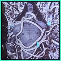 Lords of the Fallen - Door Type Lost Soul Example