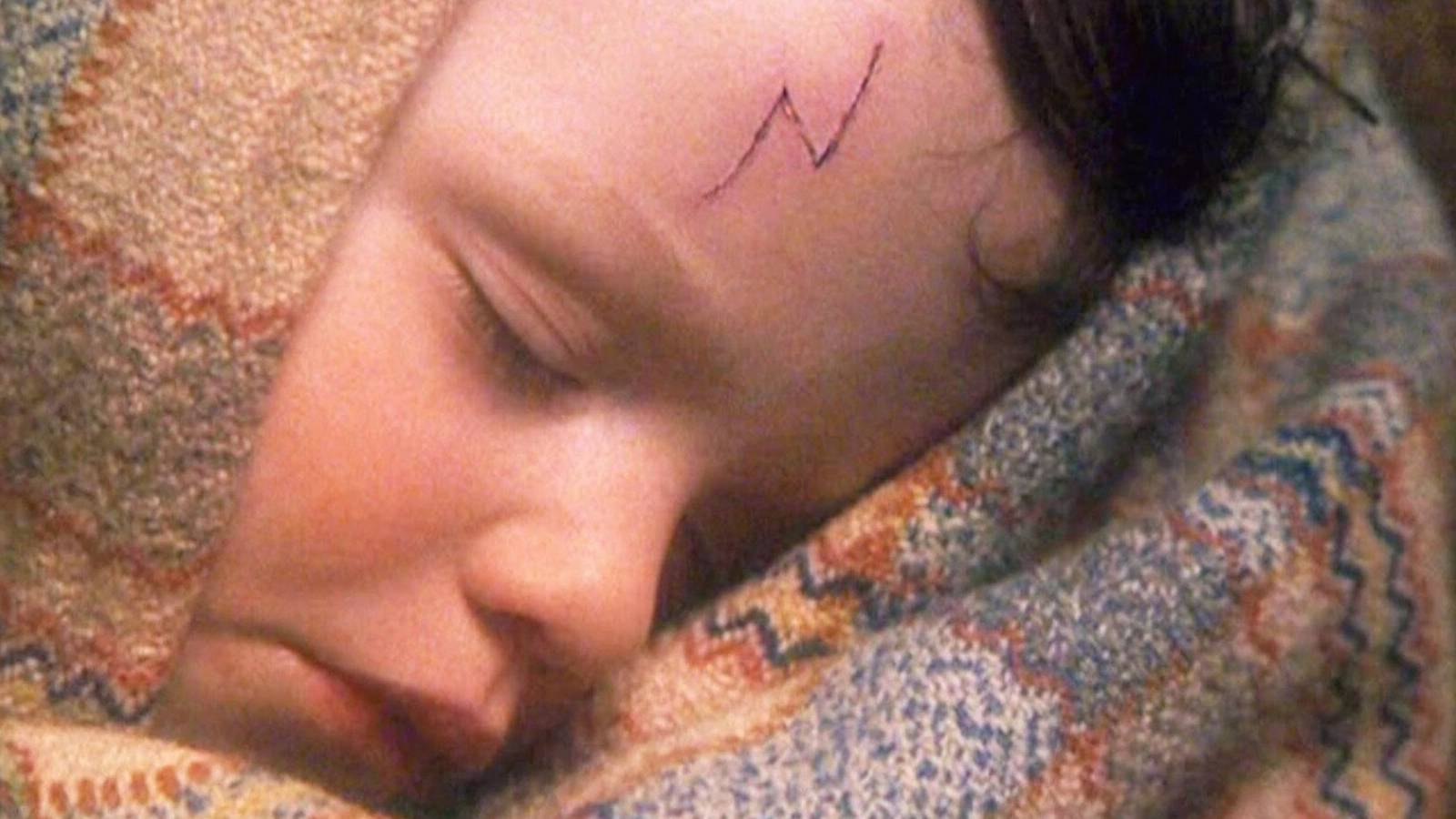 infant harry potter with a lightning bolt scar