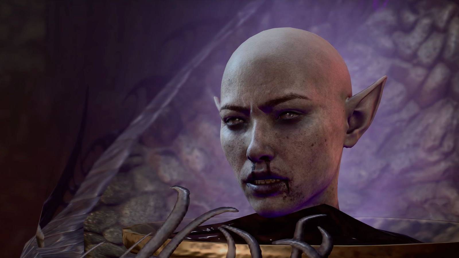 Baldur’s Gate 3: Should You Consume or Purge the Slack-Skinned Head Mind?