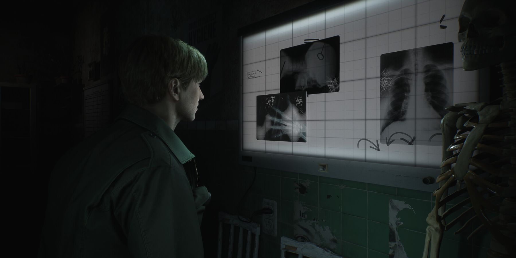 Silent Hill 2 Remake key art James in xray room