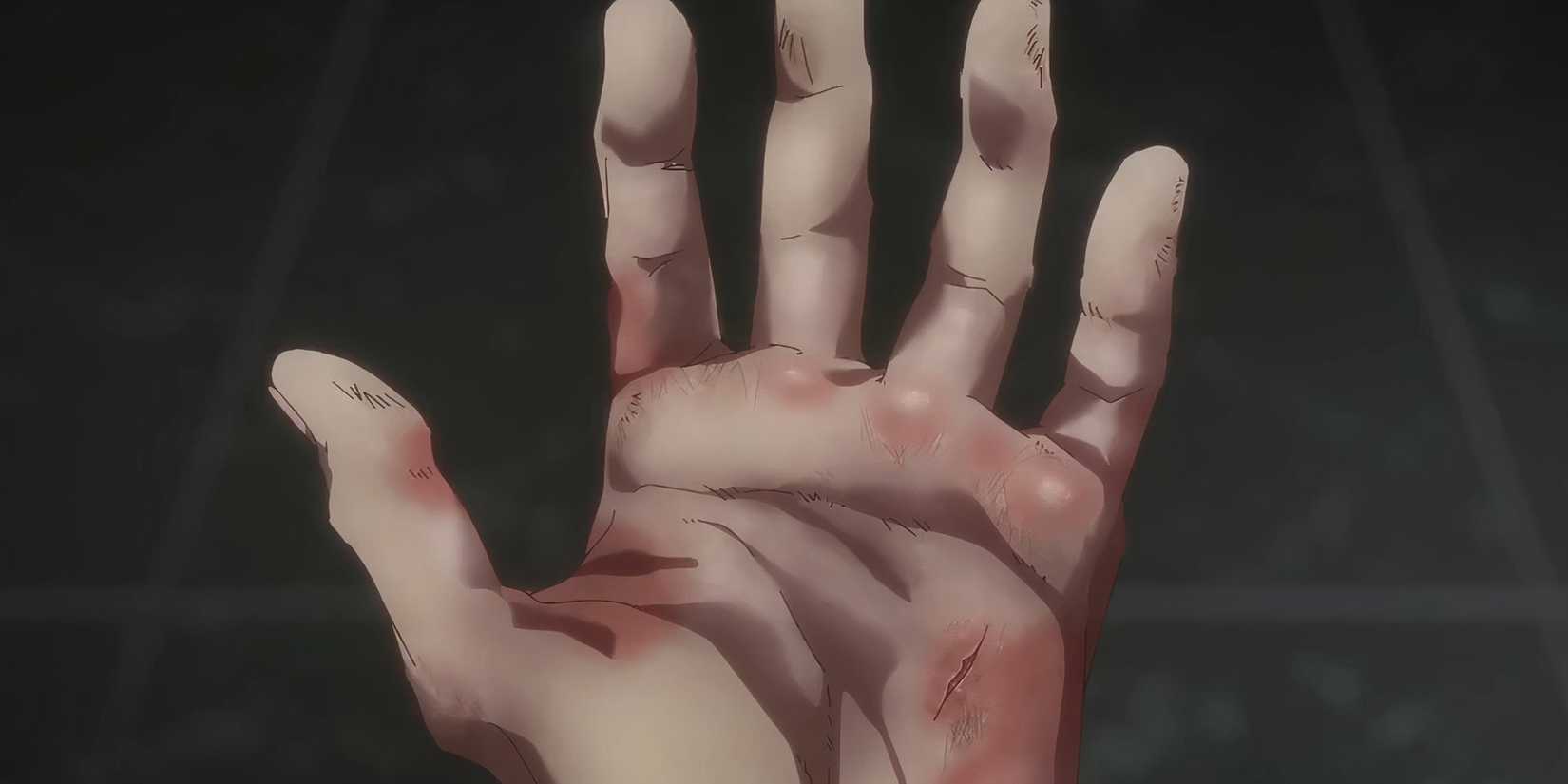 Oshi no Ko S2E6 Melt's Swollen Hand