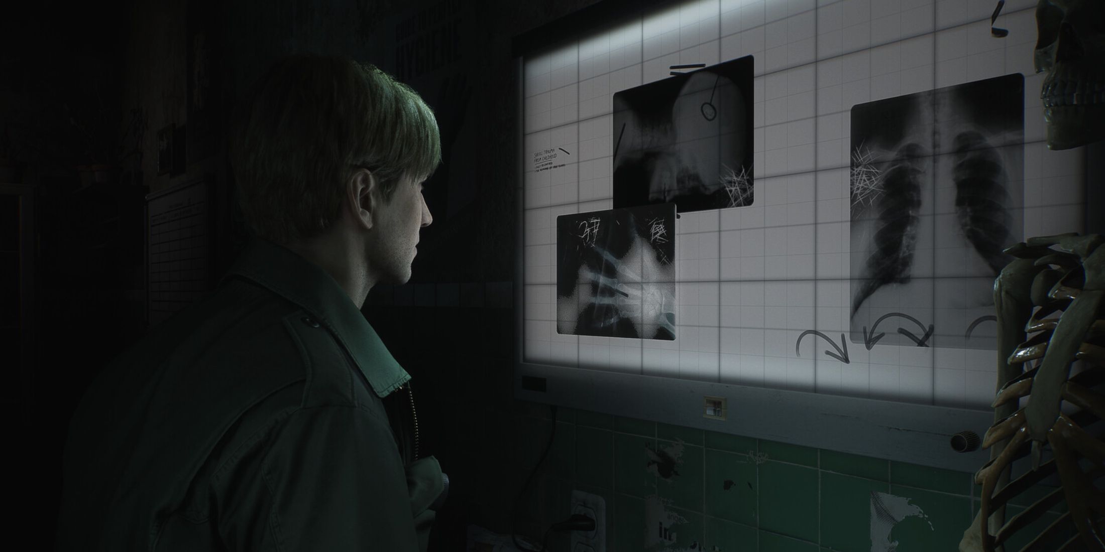 Original Silent Hill 2 Composer Has Exciting News For Fans