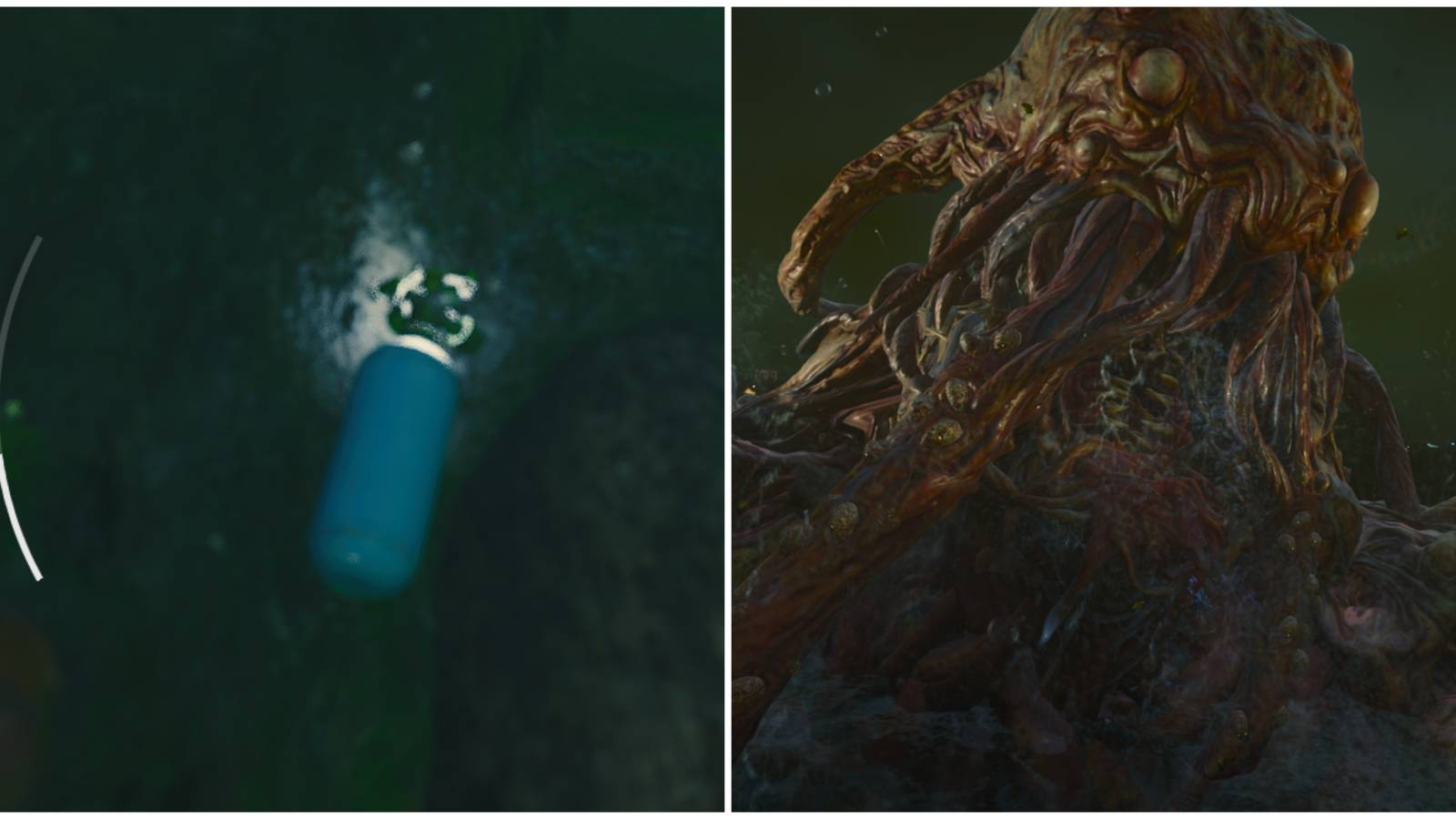 oxygen supply and patient 13