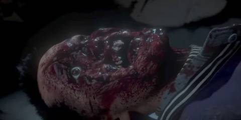 Matt's corpse after getting his face bashed in by the Wendigo