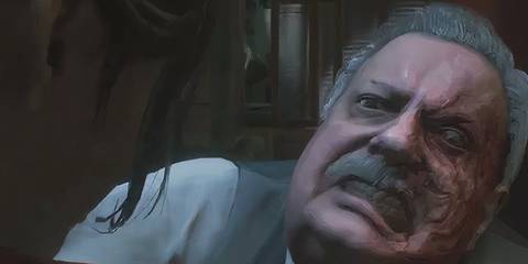 Chief Irons with the ifnection taking over his face 