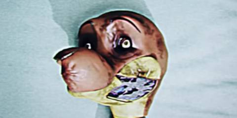 bron on surgery table in poppy playtime