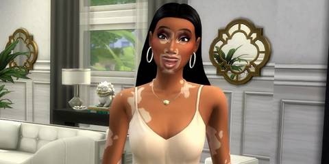 Sims 4 Vitilago skin feature