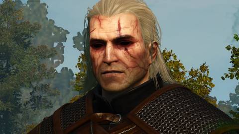Toxicity in The Witcher 3 Wild Hunt