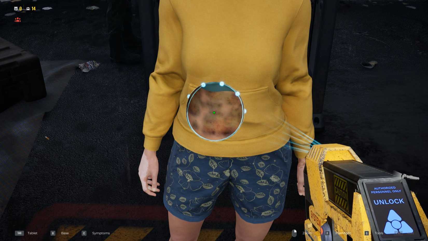 Kids Aren't Alright Bruises on Girl Quarantine Zone Last Check