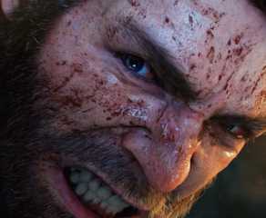 Logan angry