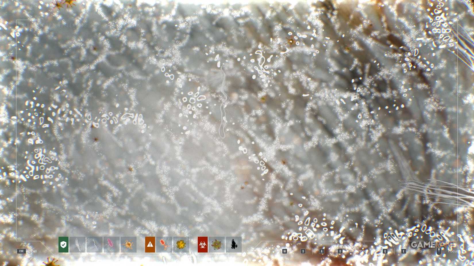 Quarantine Zone The Last Check - Matioscope - Ocular Helminth 2