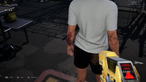 Quarantine Zone The Last Check - Symptoms - Red Bruise