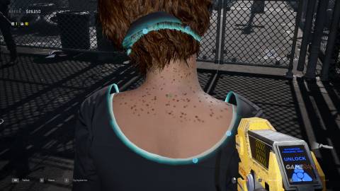 Quarantine Zone The Last Check - Symptoms - Skin Rash