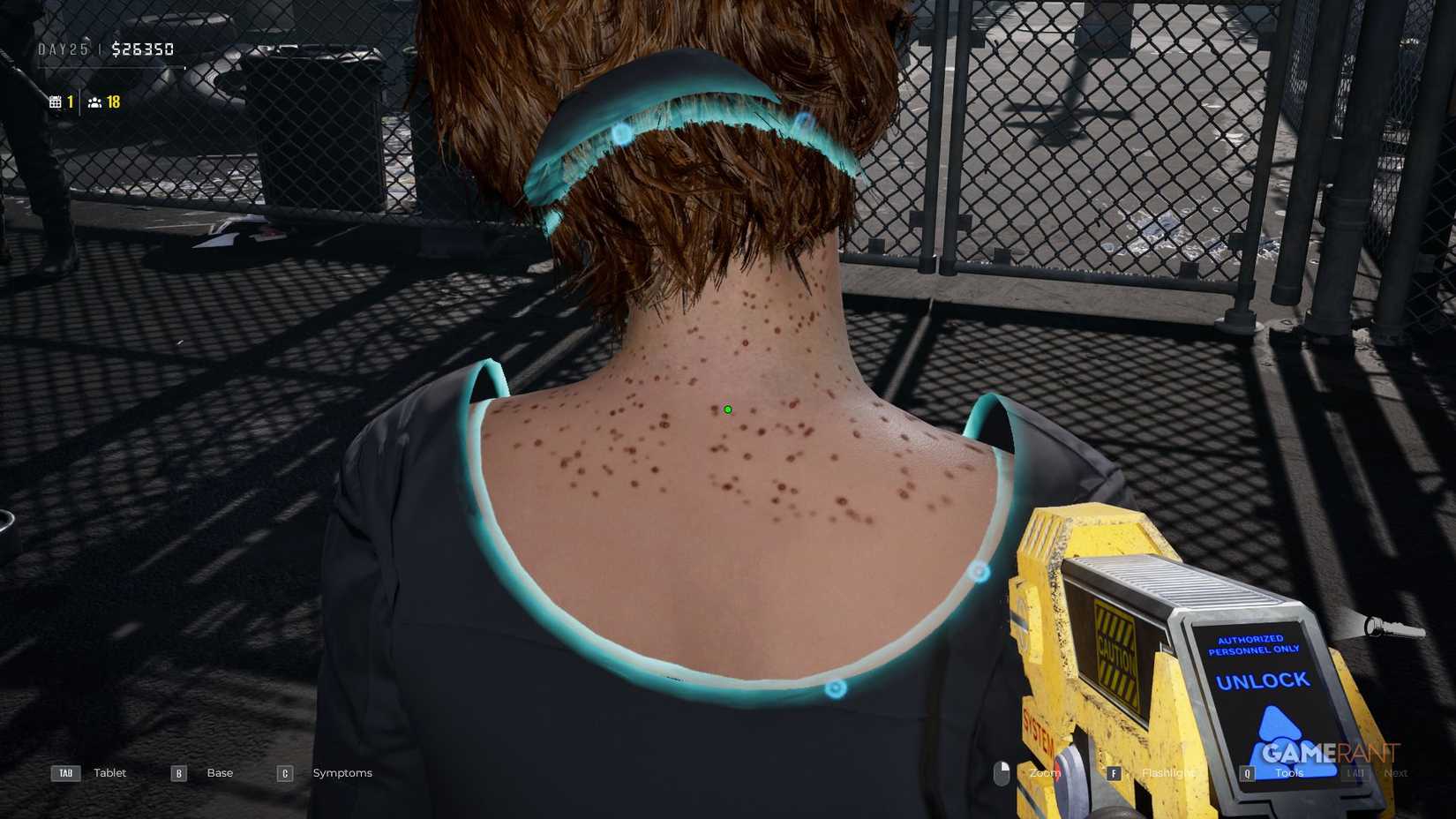 Quarantine Zone The Last Check - Symptoms - Skin Rash