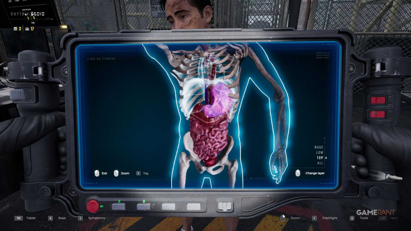 Quarantine Zone The Last Check - X-Ray - Color Difference - Liver