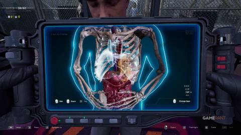 Quarantine Zone The Last Check - X-Ray - Fatty Hepatosis Liver
