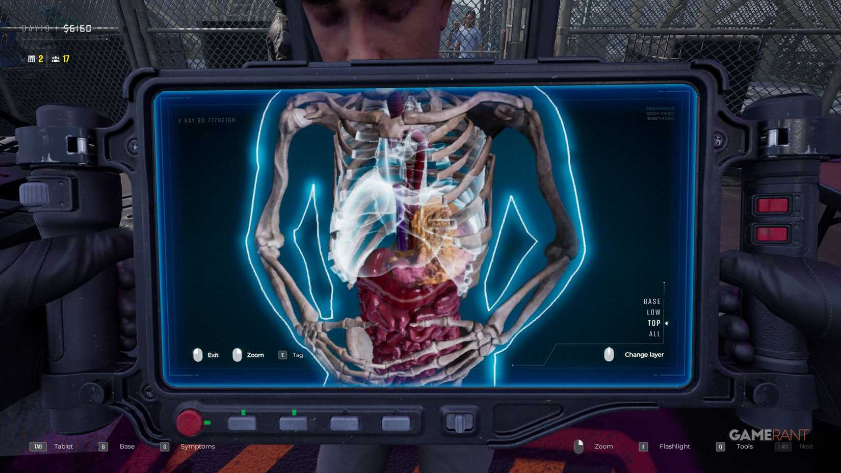 Quarantine Zone The Last Check - X-Ray - Fatty Hepatosis Liver