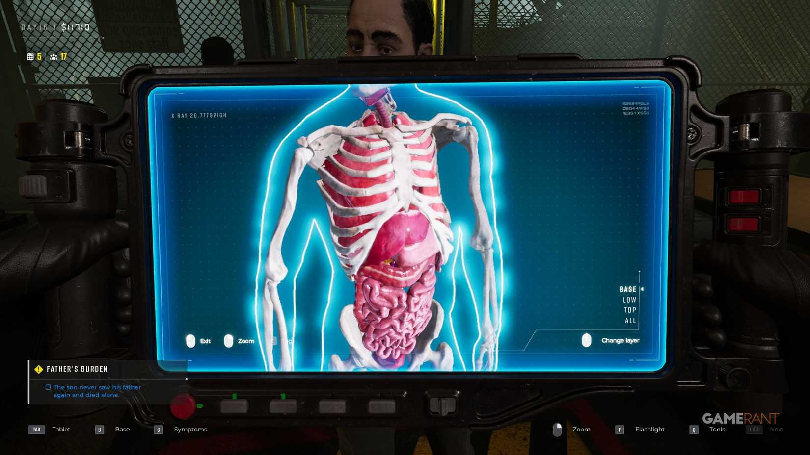 Quarantine Area Final Check - X-Ray - Healthy