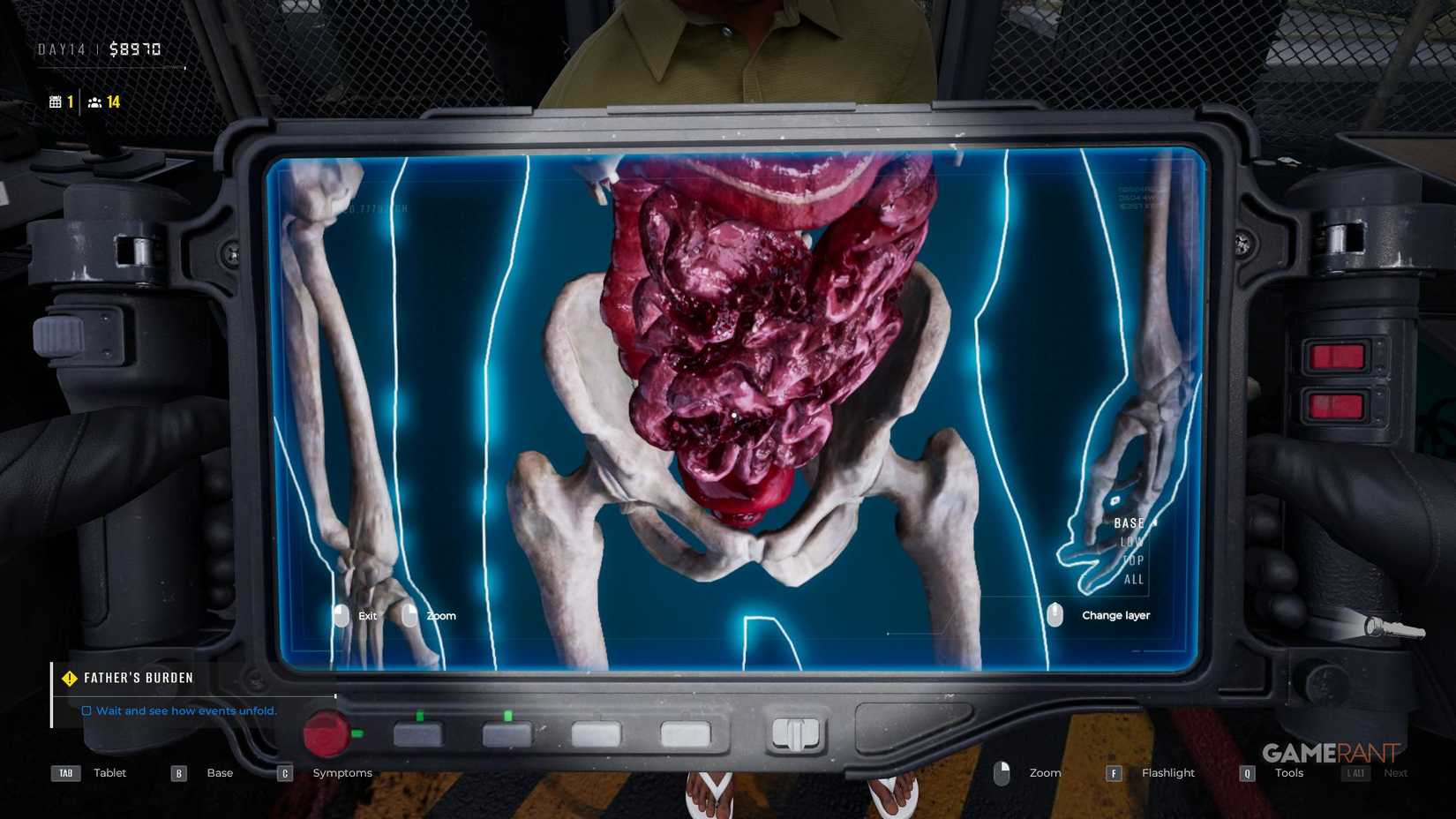 Quarantine Zone The Last Check - X-Ray - Internal Bleeding Intestines