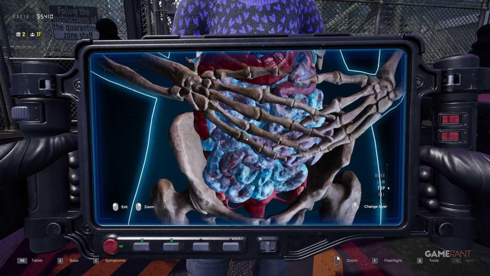 Quarantine Zone The Last Check - X-Ray - Moldy Organs Intestines