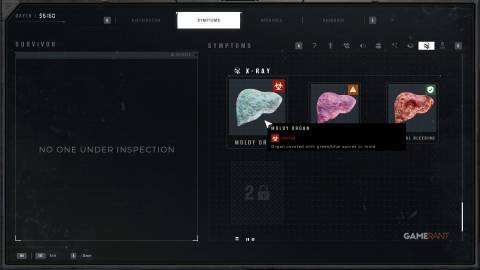 Quarantine Zone The Last Check - X-Ray - Moly Organ