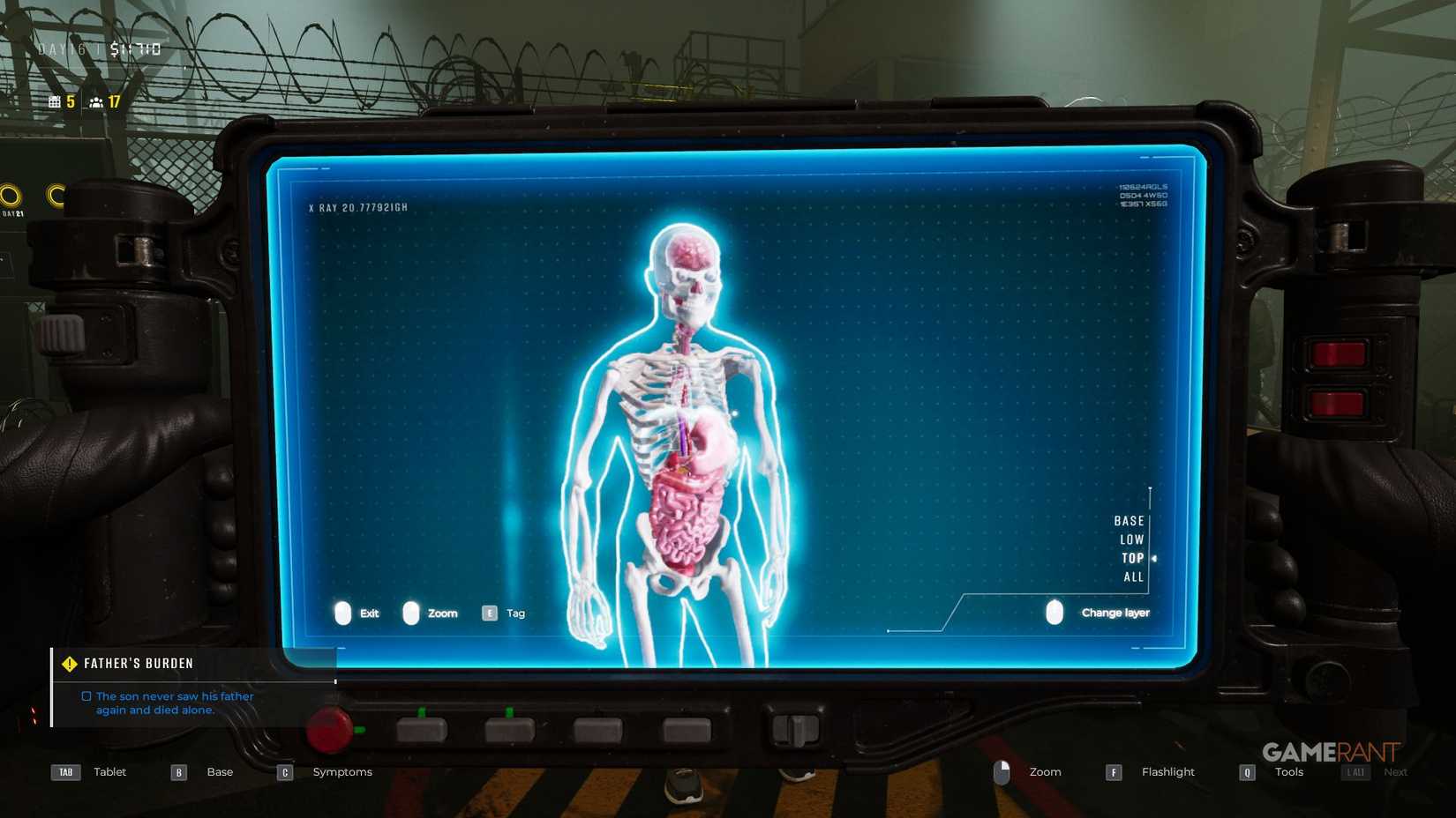Quarantine Area Final Check - X-Ray - Top