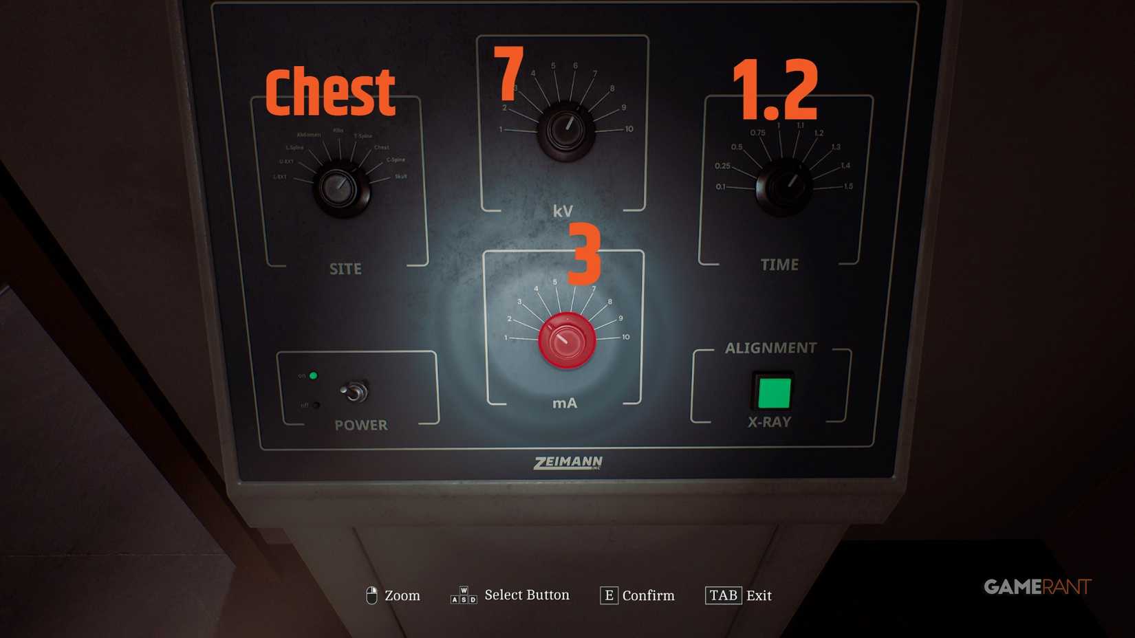 chest x-ray-1