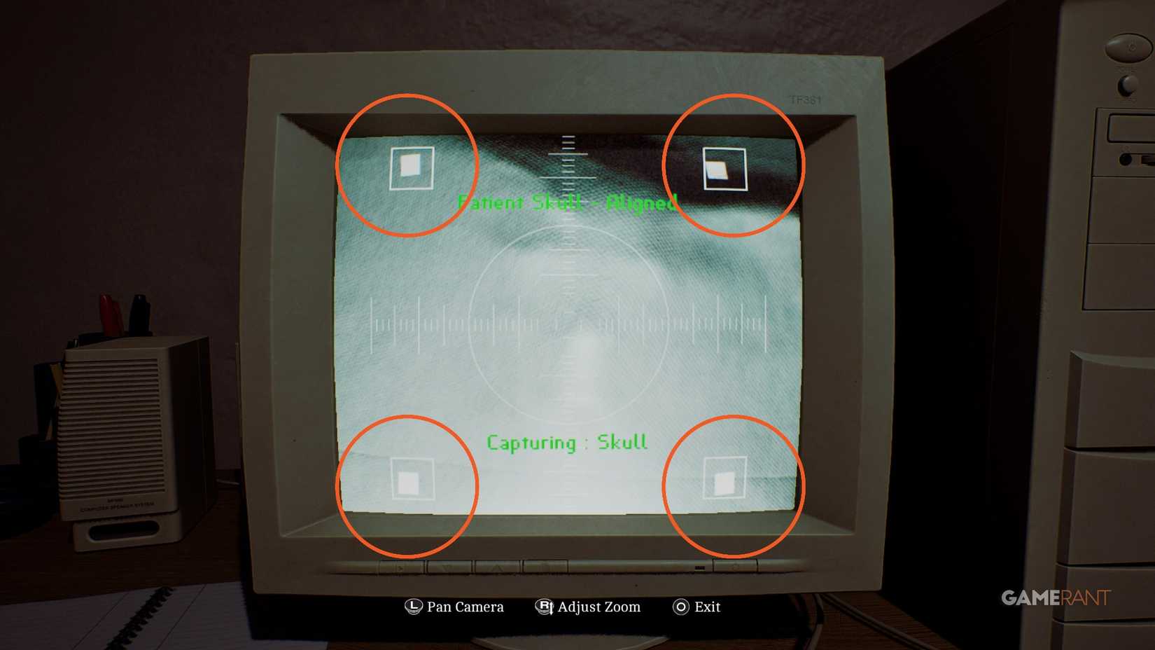 How to X-Ray the Patient's Head in Silent Hill Townfall